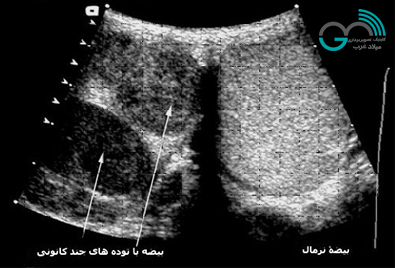 سونوگرافی بیضه ها