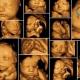 استفاده از سونوگرافی سه بعدی می تواند جنسیت یک کودک را حتی زودتر از سونوگرافی سنتی 2 بعدی تشخیص دهد. طبق تحقیقی که در مجله انگلیسی رادیولوژی در انگلستان منتشر شد، در میان 150 زن که در سه ماهه اول خود سونوگرافی 3 بعدی داشتند، 128 -- 85.3% -- پیش بینی درستی برای تعیین جنسیت انجام شده است. پیش از این هم در بخش بارداری نمناک گفتیم این پیش بینی ها در طول هفته های 11 تا 14 ام صورت گرفتند و نشان دادند که سونوگرافی سه بعدی می تواند راهی موثر برای تشخیص جنسیت نوزاد در سه ماهه اول باشد.