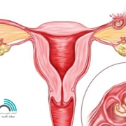 تشخیص بارداری خارج رحمی با سونوگرافی