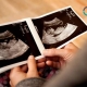 اسکن آنومالی و موارد قابل بررسی کلینیک میلاد غرب