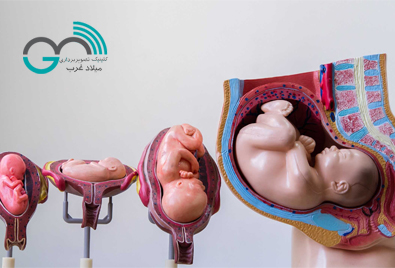 حاملگی مولار و خطرات آن/کلینک میلاد غرب
