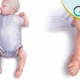 چگونه پاچنبری را تشخیص دهیم؟ / سونوگرافی میلاد غرب