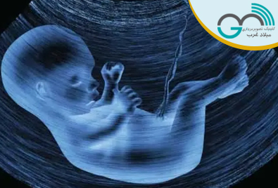 اهمیت سونوگرافی NT(تست غربالگری اوایل بارداری(/سونوگرافی میلاد غرب