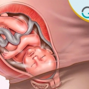 نقش سونوگرافی در بررسی جفت، مایع آمنیوتیک و بند ناف /سونوگرافی در غرب تهران